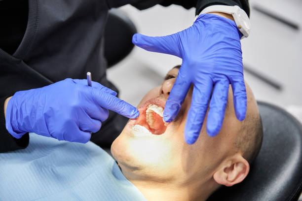 Best Broken or Chipped Tooth Repair in Bellwood, PA
